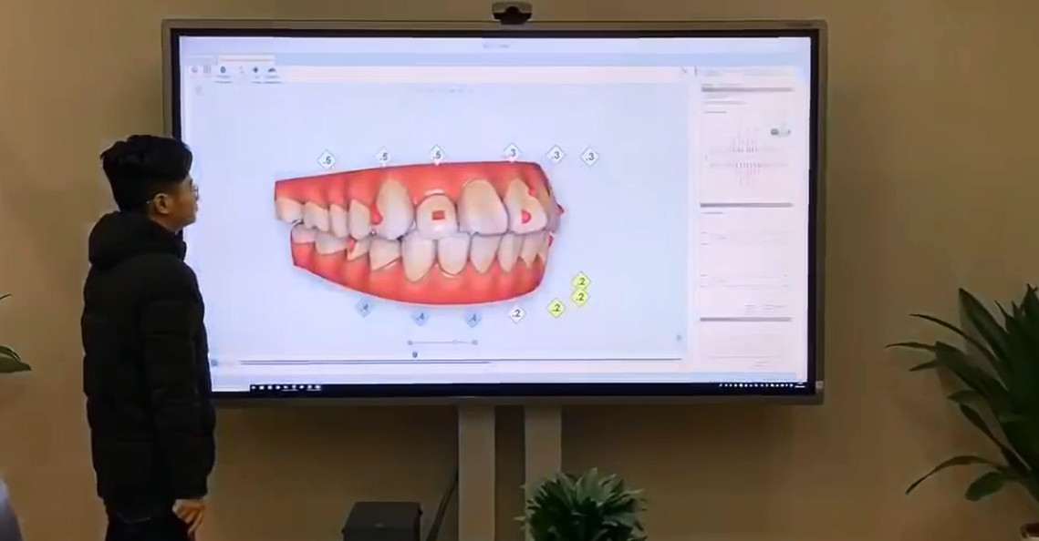 Horion case study